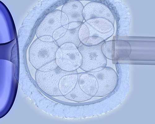 武汉协和医院供卵代孕步骤详解与费用指南